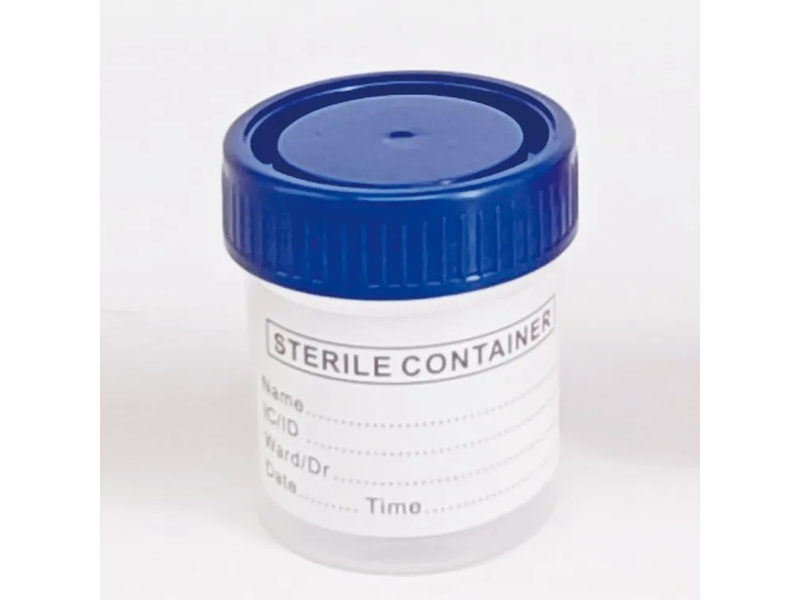 Plastic Stool Urine Container Specimen Cup 30ml 40ml 60ml 120ml