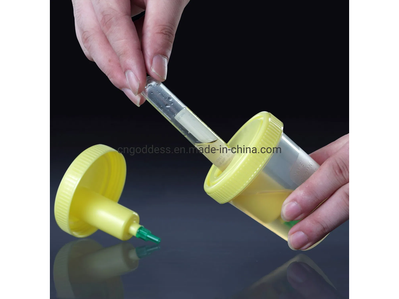 100ml Sterile Urine Container Vacuum Urine Cup