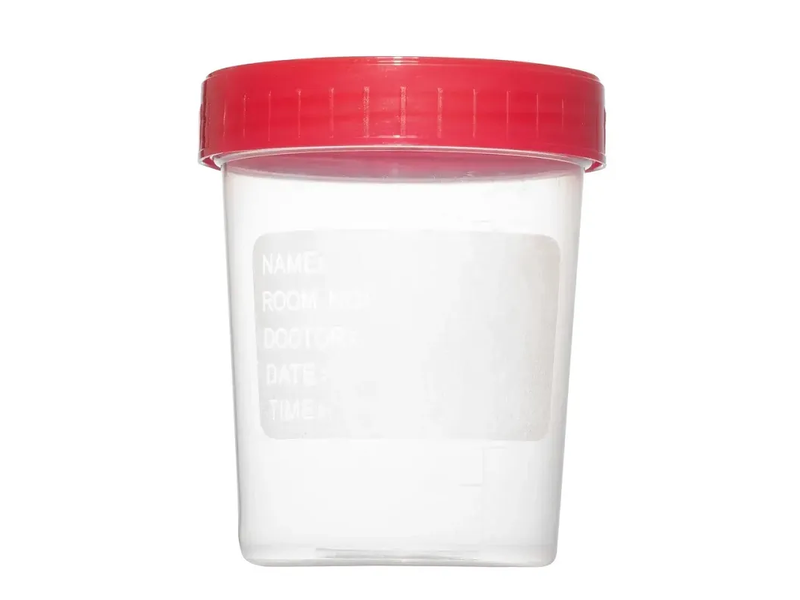 Sterile Hospital Urine Specimen Cup Urine Sample Containers Urine Collection Cup 60ml
