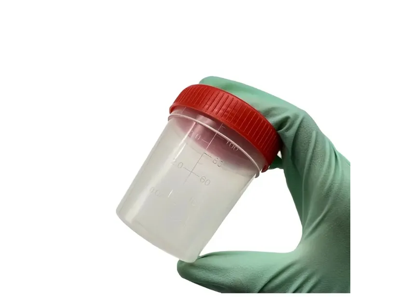 Urine Specimen Cups